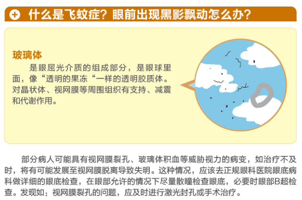 【看圖學知識】眼前有黑影該怎么辦