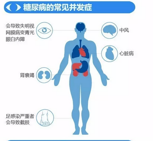 你造嗎？糖尿病晚期眼睛會(huì)致盲！