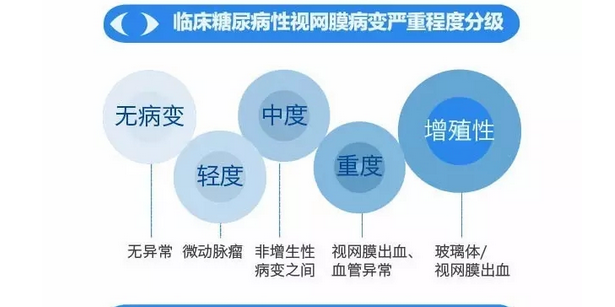 你造嗎？糖尿病晚期眼睛會(huì)致盲！